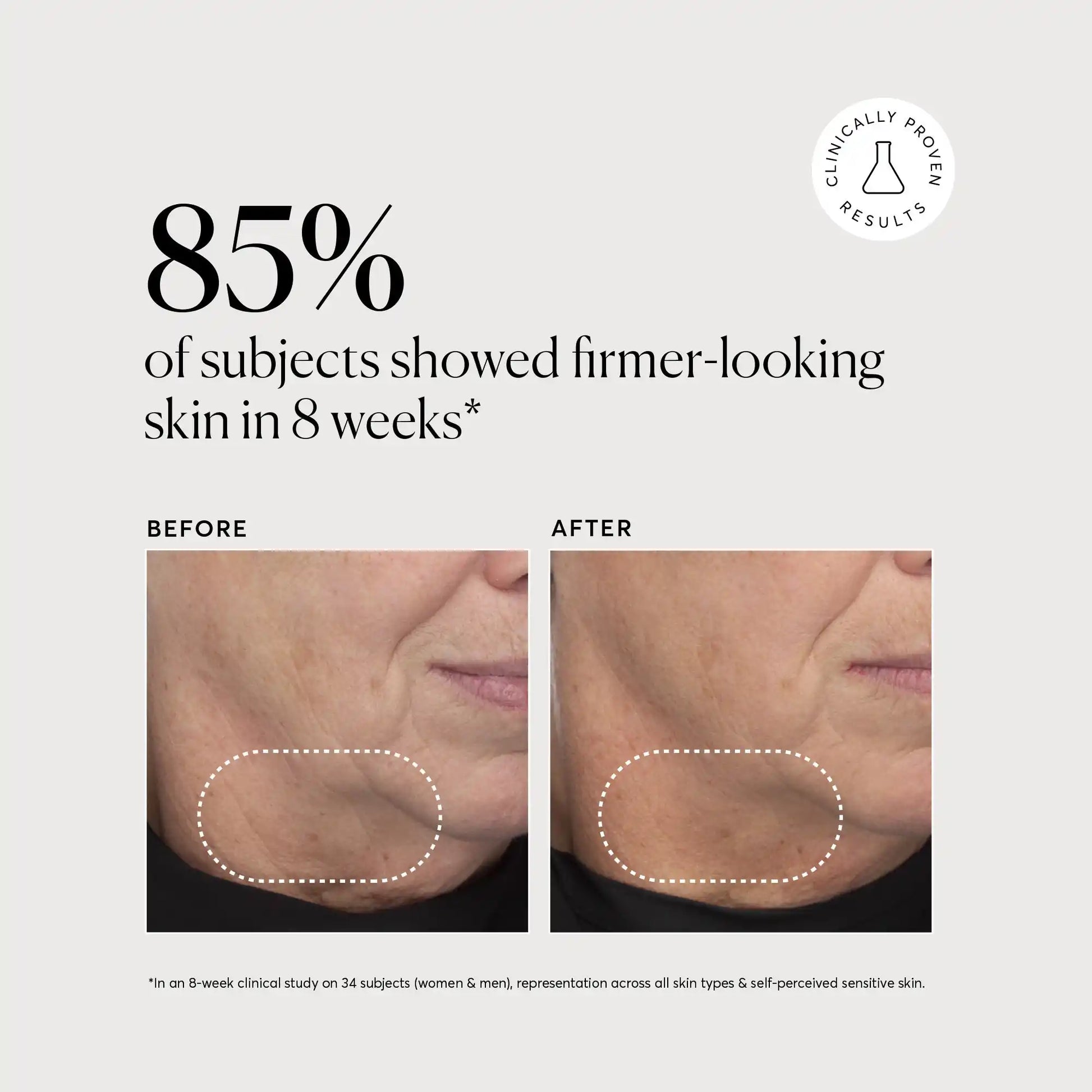 retinol-complex-serum-u2 NATR-10034-Alt-Images-Retinol-Complex-Serum-04.webp